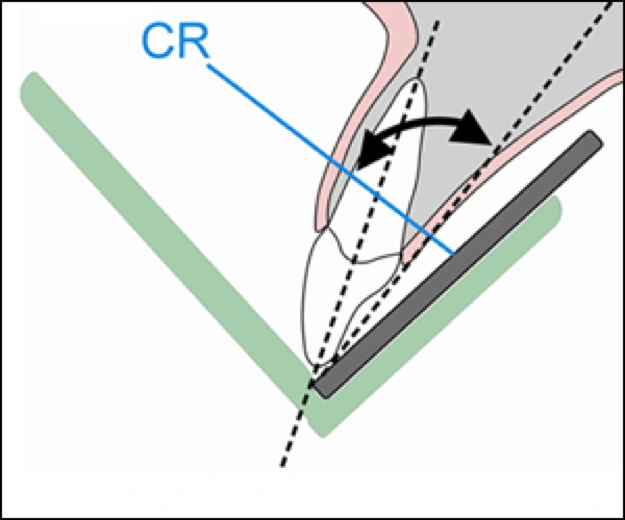 Intraoral Radiographic Techniques Intraoral Imaging Basic Principles