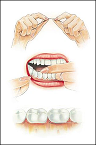 ce542 - Content - Oral Hygiene - Figure 1