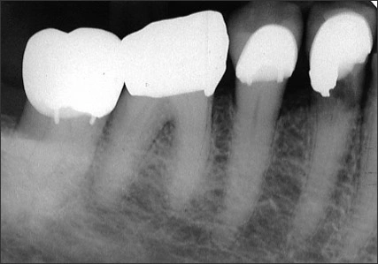 Resorptive Processes - Anomalies of Tooth Structure - Dentalcare