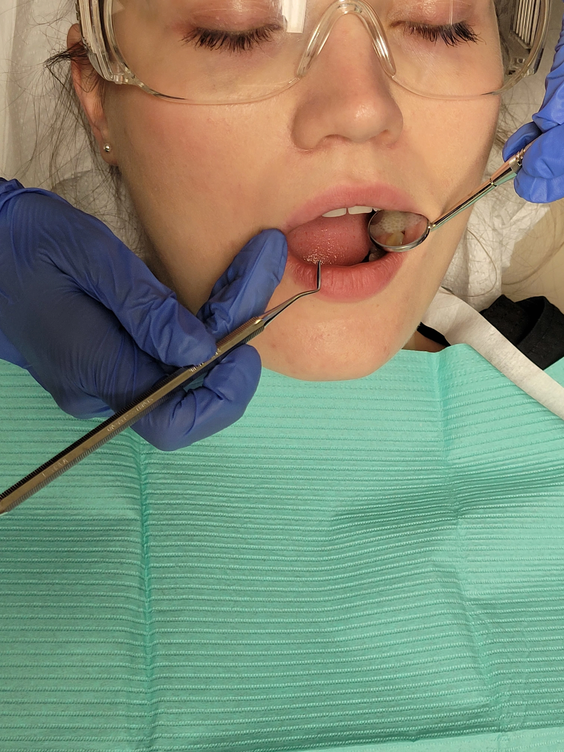 Operator Responsibilities The Concepts of Fourhanded Dentistry