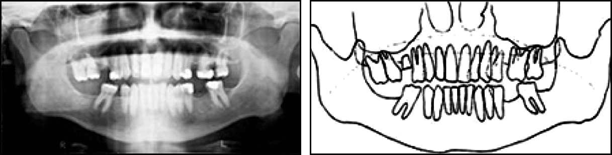 ce589 - Content - Tissue Projection Errors - Figure 6