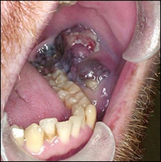 fig04-lesion-oblique-view