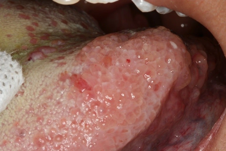 Case Challenge 66 - Content - Select Diagnosis - Figure 1