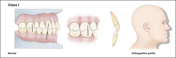 Occlusion - An Overview of Dental Anatomy - Dentalcare