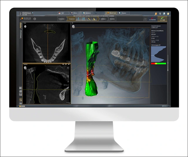 Threedimensional Extraoral Digital Imaging Digital Imaging in