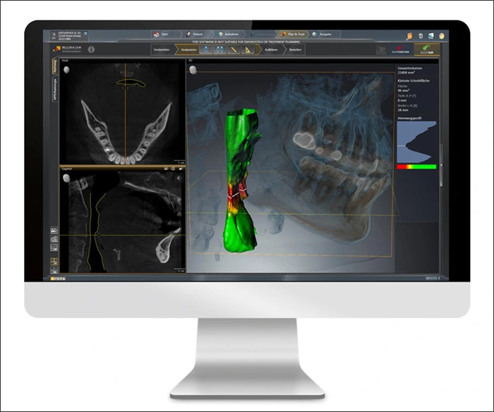 Photograph showing 3D Digital Imaging System.