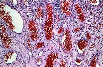 image showing photomicrograph of blood vessels
