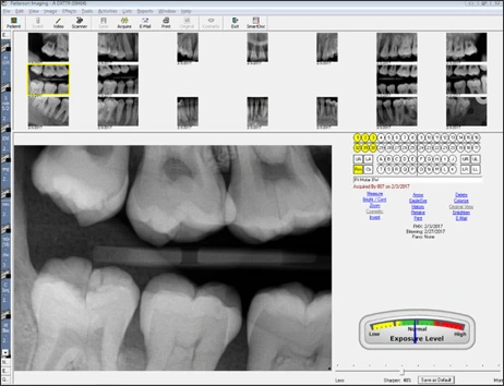 Photograph showing Digital Full-mouth Series.