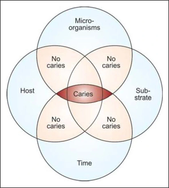 Venn diagram showing caries possibilities