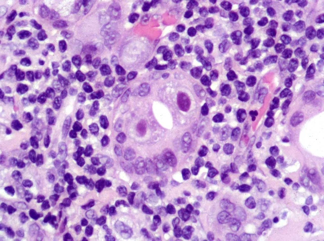 Case Challenge 57 - Content - Diagnostic Information - Figure 4