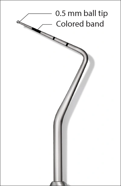 Illustration showing a ball-tipped periodontal probe used to enhance patient comfort and assist in detect overhanging margins and subgingival calculus