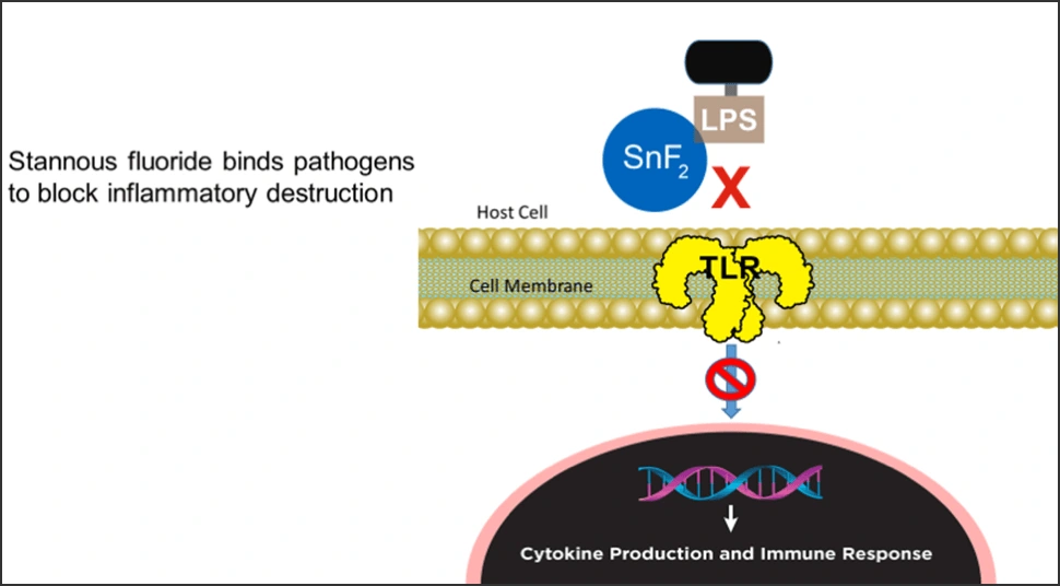Illustration showing stannous fluoride binds pathogens to block inflammatory destruction
