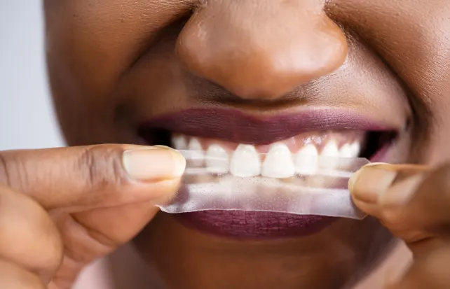 Patient Education Topic - Teeth Whitening