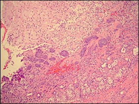 fig03-photomicrograph-low-2