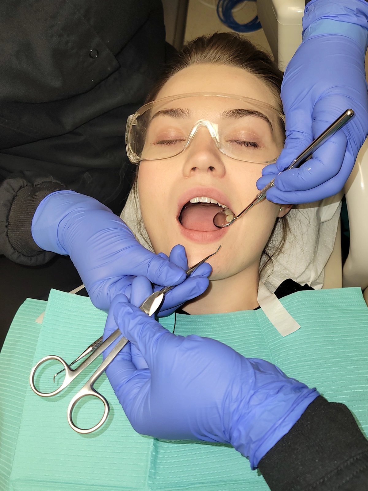 Delivery of Scissors or Hinged Instruments The Concepts of Four