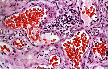 image showing photomicrograph of capillaries