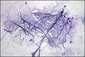 Case Challenge 26 - Content - Diagnostic Information - Figure 3