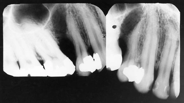 Case Challenge 2 - Content - Select Diagnosis - Figure 1