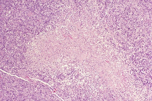 Case Challenge 69 - Content - Diagnostic Information - Figure 3