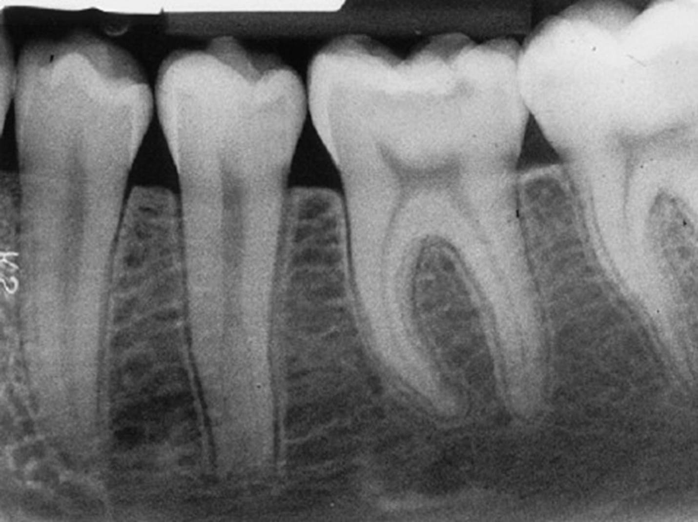 ce651 - Images - Figure 39