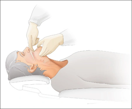 ce516 - Content - Airway Obstruction (Foreign Object) - Figure 2