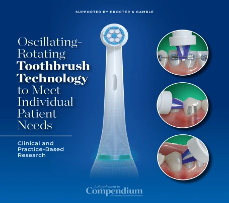 Why Personalized Oral Hygiene Technology Matters