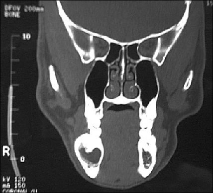 Case Challenge 12 - Content - Diagnostic Information - Figure 12