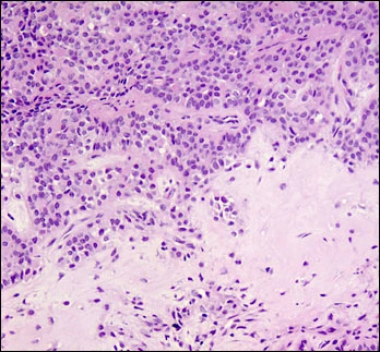 case challenge 24 diagnostic introduction fig03-photomicrograph-high