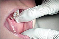 ce337 - Content - Buccal Mucosa - Figure 1