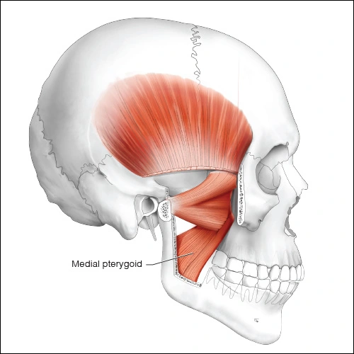 Medial Pterygoid - Head and Neck Anatomy: Part II – Musculature ...