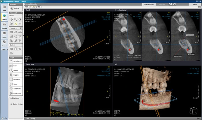 Photograph showing 3D Imaging for Diagnoses.