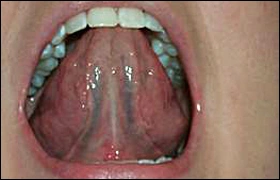 ce337 - Content - Tongue - Figure 3