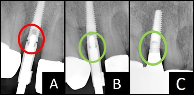 ce660 - Fig 33