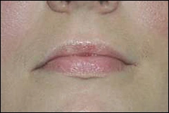 ce337 - Content - Lips - Figure 1