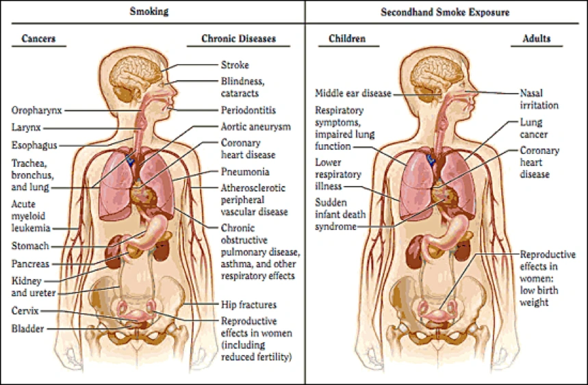Image showing the health consequences linked to smoking and secondhand smoke.