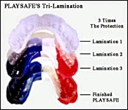 image showing a tri-laminated mouthguard