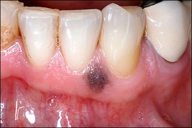 Case Challenge 35 - Content - Select Diagnosis - Figure 1