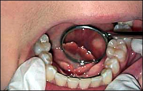 ce337 - Content - Mandible - Figure 2