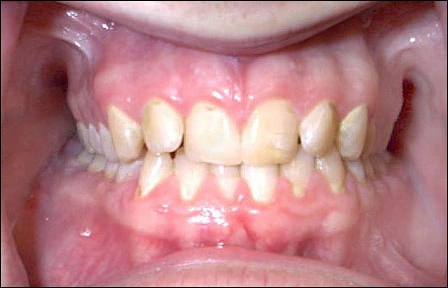 Case Challenge 12 - Content - Diagnostic Information - Figure 1