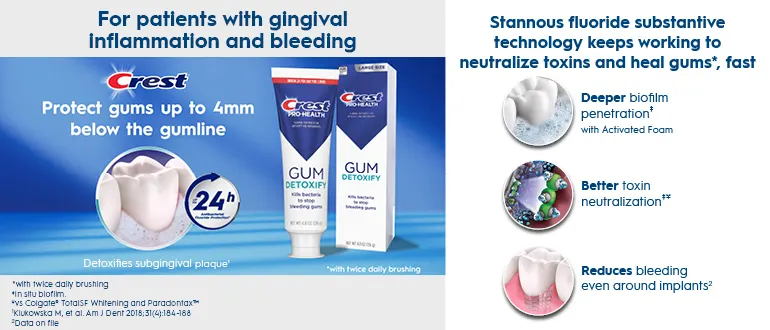 Crest goes beyond the brush to extend the life of teeth