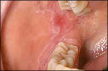 Case Challenge 23 - Content - Diagnostic Information - Figure 1 striae right