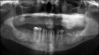 Case Challenge 51 - Content - Diagnostic Information - Figure 2