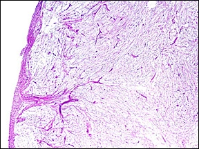 Case Challenge 12 - Content - Diagnostic Information - Figure 7