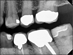 ce468 fig04 radiographic