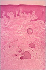 Case Challenge 10 - Content - Diagnostic Information - Figure 7