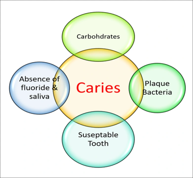 factors in dental caries process