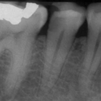 CE562 - Content - Current Radiographic Examination Including Periapical, Bitewings, and/or CBCT - Figure 1