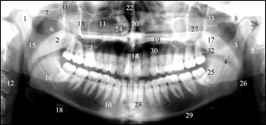 Features of an Ideal Panoramic Radiograph - Figure 10