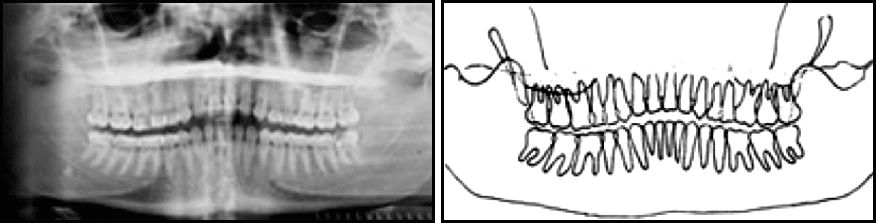 ce589 - Content - Incorrect Head Orientation - Figure 5