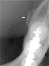 Figure 4.
Case Challenge 13 - Content - Diagnostic Information - Figure 4